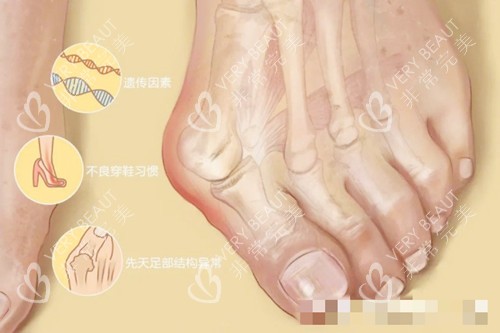 大腳骨圖示