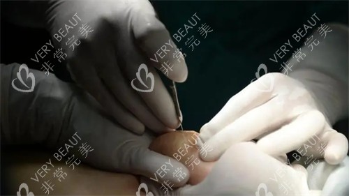 面部抗衰對(duì)比