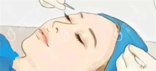 注射美容圖片