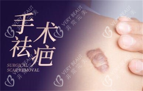手術(shù)疤痕祛除改善圖
