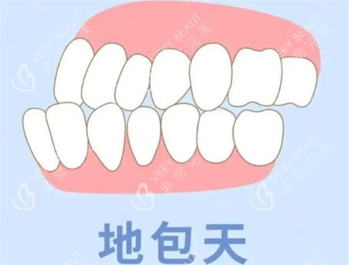 地包天动画展示图