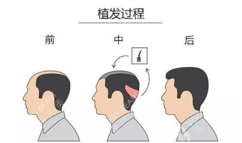 頭頂加密過程示意圖