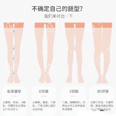 腿型矯正圖