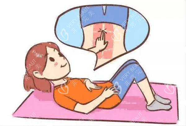 腹直肌分离