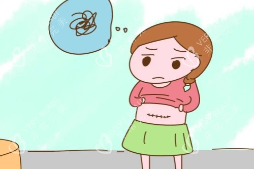 剖腹產(chǎn)疤痕卡通圖