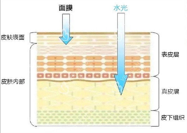 水光注射