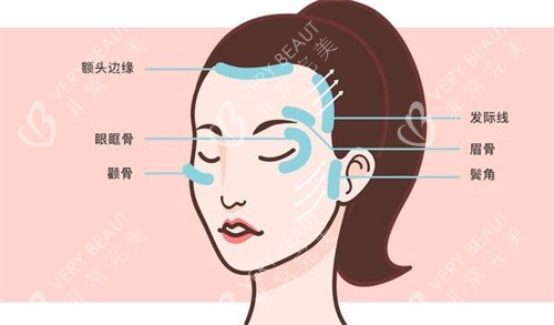 面部提升區(qū)域