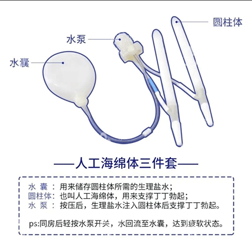 人工海綿體三件套