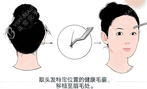 植眉原理图