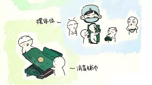 3d生物束带紧缩术手术步骤漫画图