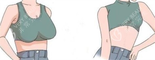 巨乳缩小
