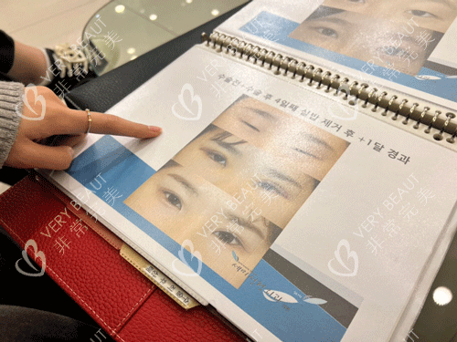 韩国世美整形手术实例图册