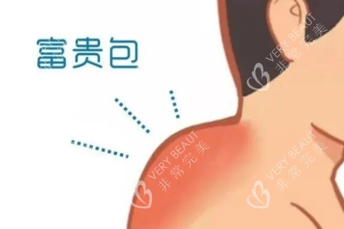 富贵包卡通展示图
