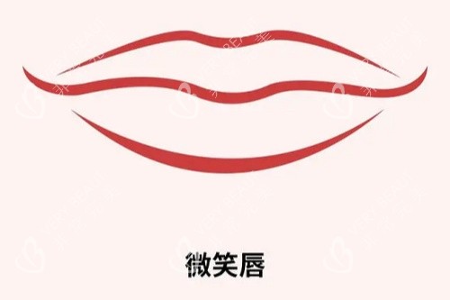 微笑唇展示图