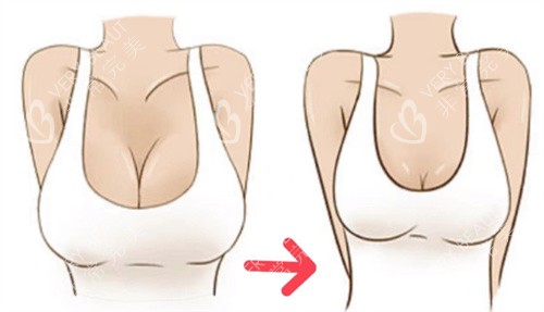 巨乳缩小卡通
