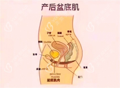 产后盆底肌