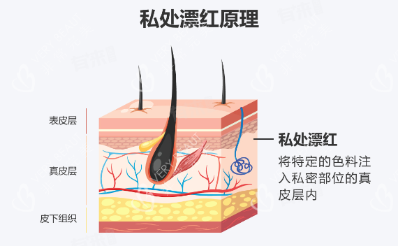 阴唇漂红原理
