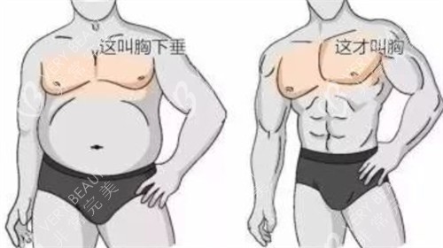 男性胸部对比