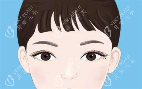 宁波初美星范双眼皮展示