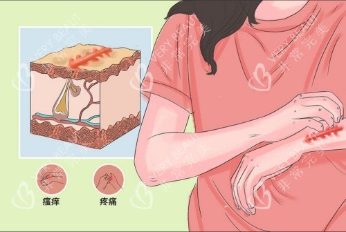 疤痕增生引起的症状示意图