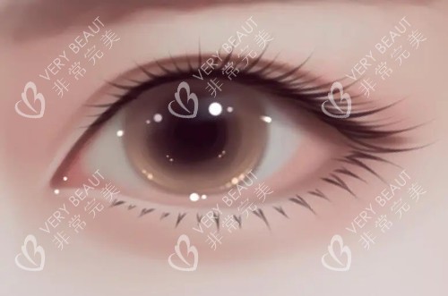 眼综合.webp