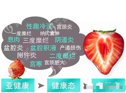 菲蜜丽解问题图示