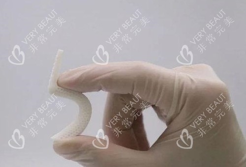 超体隆鼻照片展示图