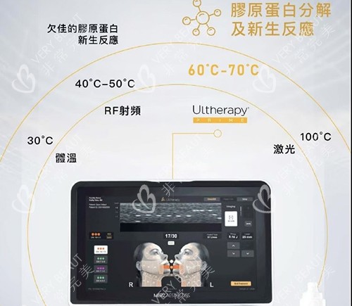 美版***二代
