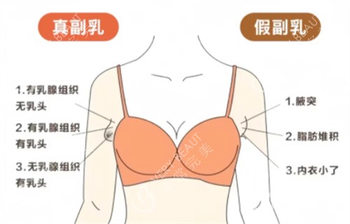 吸脂前与吸脂后对比素材图
