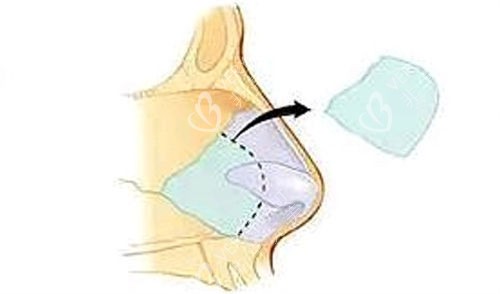 韓國(guó)PPEUM皮膚科盥洗室