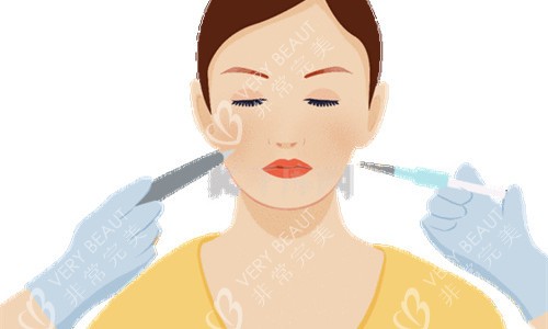 水光注射圖 水光注射圖