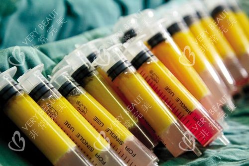 自體脂肪豐胸脂肪 自體脂肪豐胸脂肪