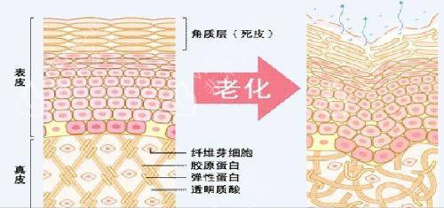 皮膚老化前后內(nèi)部組織形態(tài)示意圖 皮膚老化前后內(nèi)部組織形態(tài)示意圖