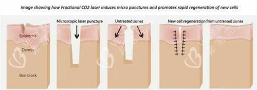 身体疤痕 身体疤痕
