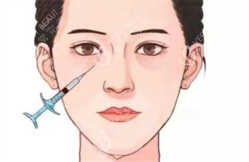 泪沟注射 泪沟注射