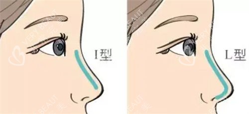 隆鼻不同形态假体呈现图