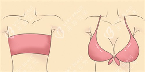 大胸缩小 大胸缩小