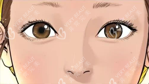 自然双眼皮 自然双眼皮