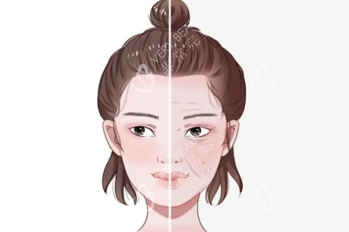 面部皮肤改善图