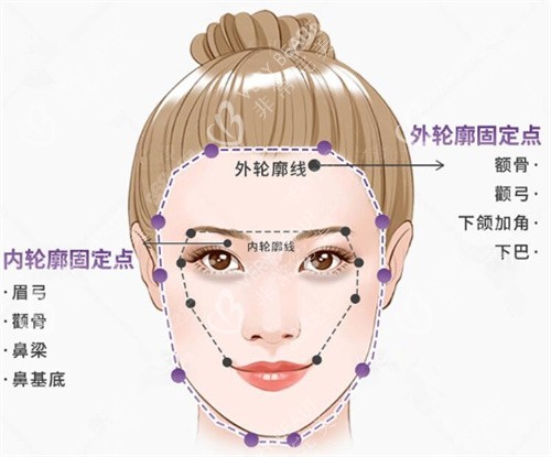 轮廓固定图示 轮廓固定图示