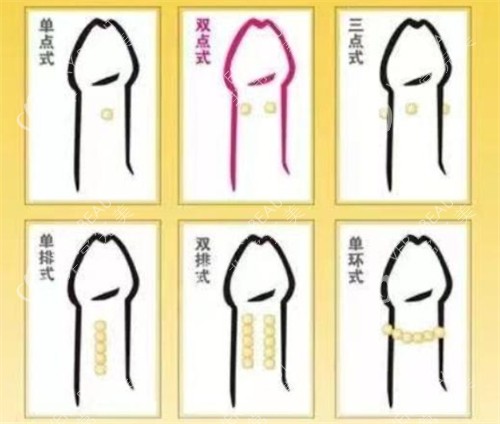 阴茎入珠术款式 阴茎入珠术款式