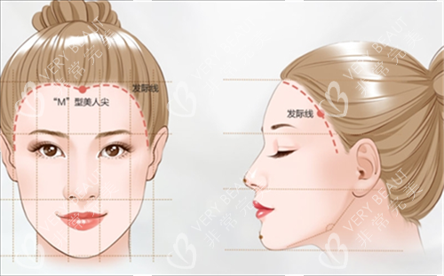M型发际线素材 M型发际线素材