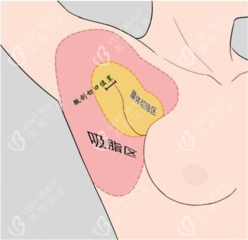 改善皮肤色素疤痕 改善皮肤色素疤痕