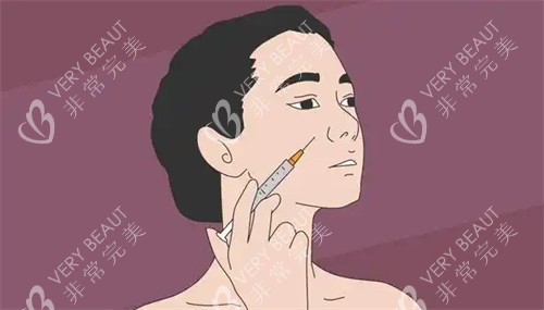 面部注射图 面部注射图