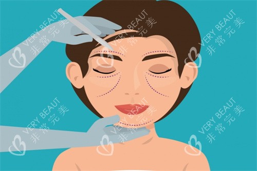 面部提升卡通图 面部提升卡通图