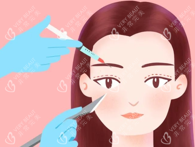 双眼皮画线展示图