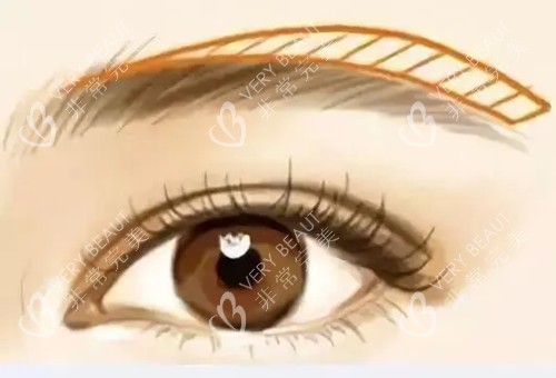 提眉位置卡通示意图 提眉位置卡通示意图