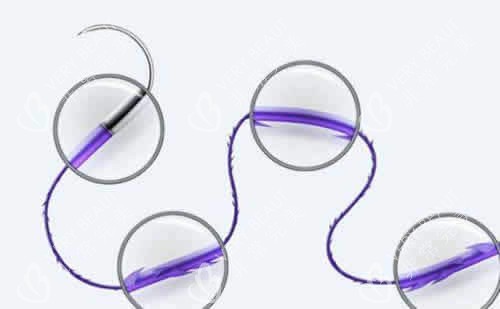 埋线提升的线材照片 埋线提升的线材照片