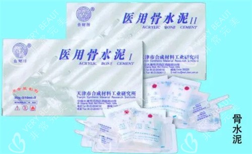 骨水泥材质 骨水泥材质