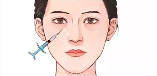 泪沟注射填充位置展示动画图 泪沟注射填充位置展示动画图